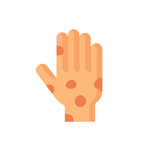 Alergias Alimentarias