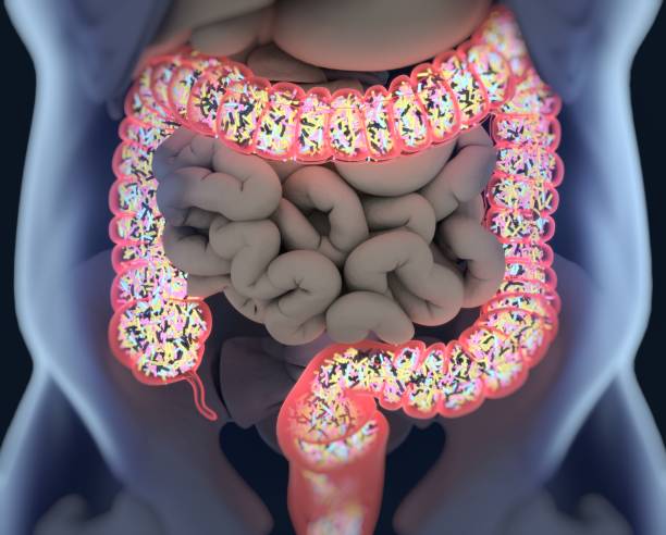 microbiota intestinal e intestino irritable